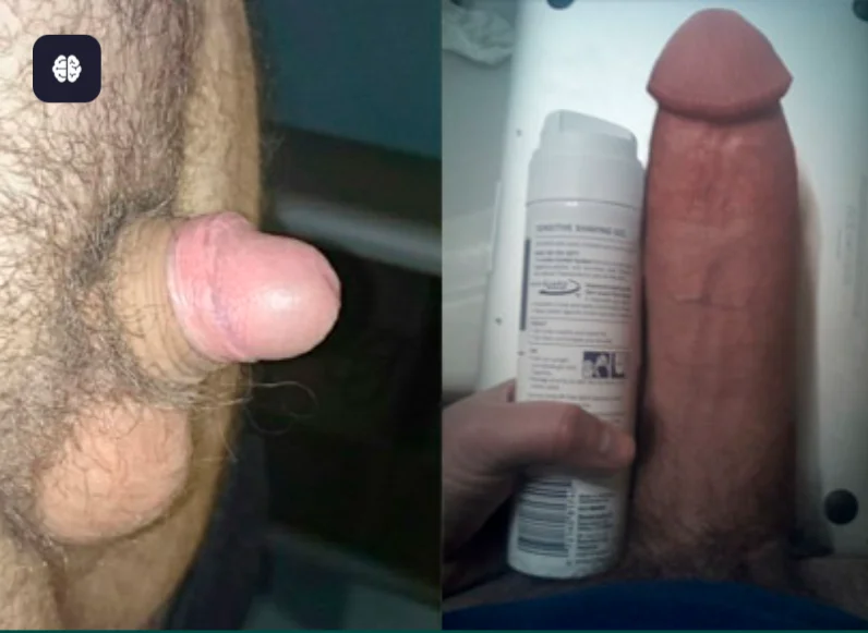 Clinical Study Result